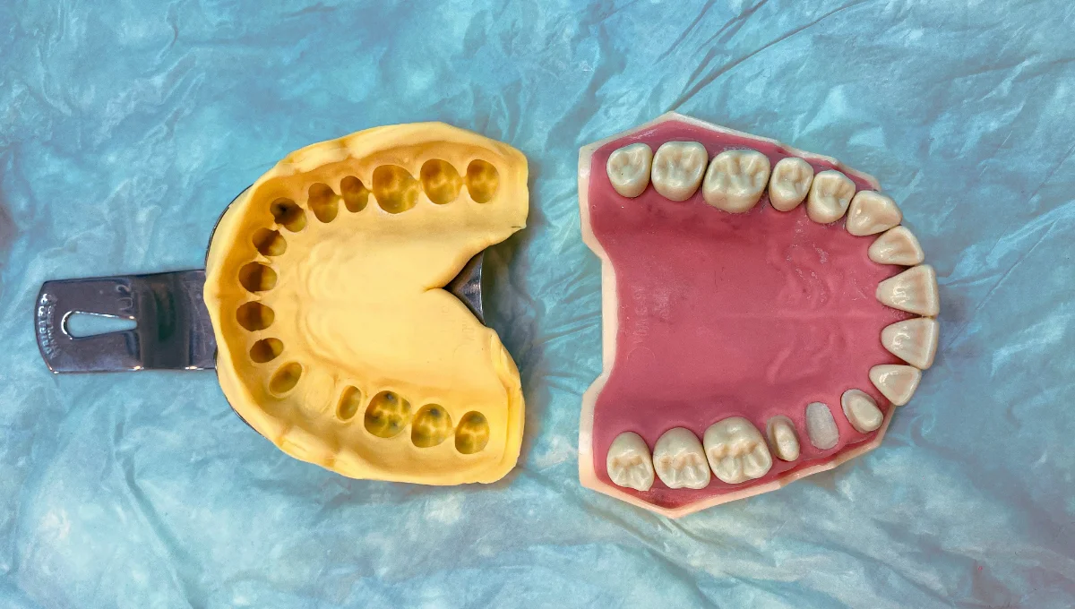 Zahnbrücken werden im Dentallabor angefertigt.